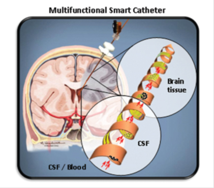 Multifunctional Smart Catheter illustration